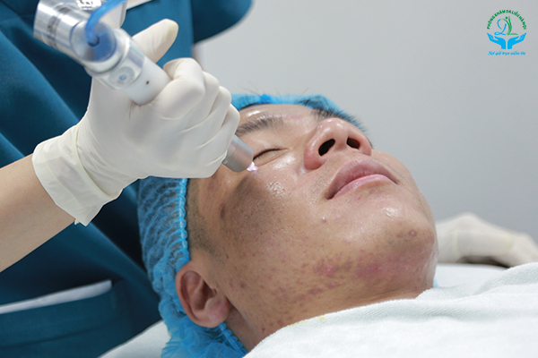Trị mụn y khoa